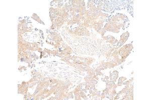 Immunohistochemistry (IHC) image for anti-RPTOR Independent Companion of mTOR, Complex 2 (RICTOR) (C-Term) antibody (ABIN7795814) (Recombinant RICTOR 抗体  (C-Term))
