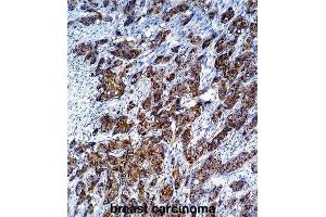 Immunohistochemistry (IHC) image for anti-Galectin 3 (LGALS3) antibody (ABIN2995387) (Galectin 3 抗体)