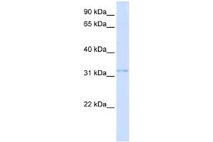 WB Suggested Anti-VDAC2 Antibody Titration:  0. (VDAC2 抗体  (N-Term))