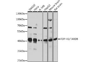 Western blot analysis of extracts of various cell lines, using TDP-43/TARDB antibody  at 1:1000 dilution. (TARDBP 抗体  (AA 1-100))