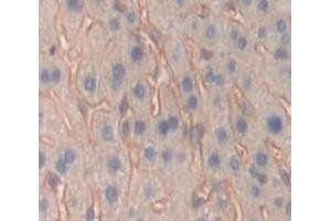 Used in DAB staining on fromalin fixed paraffin- embedded Kidney tissue (PTPRO 抗体  (AA 948-1205))
