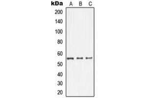 Western blot analysis of GDI1 expression in HepG2 (A), U87MG (B), SHSY5Y (C) whole cell lysates. (GDI1 抗体  (C-Term))
