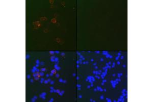 Immunofluorescence analysis of 293T-N and 293T cells using SARS-CoV-2 Nucleoprotein antibody (ABIN7269048) at dilution of 1:100. (Nucleoprotein 抗体)