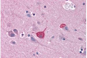 Human Brain, Cortex: Formalin-Fixed, Paraffin-Embedded (FFPE) (BOK 抗体  (C-Term))