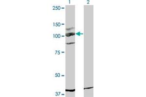 Western Blot analysis of KIT expression in transfected 293T cell line by KIT monoclonal antibody (M05), clone 5F6. (KIT 抗体  (AA 41-140))