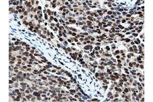Immunohistochemical staining of paraffin-embedded Human Kidney tissue using anti-NT5DC1 mouse monoclonal antibody. (NT5DC1 抗体)