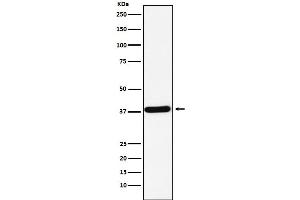Western blot analysis of CRKII expression in K562 cell lysate. (Recombinant Crk 抗体)