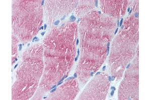 Anti-ARL6 antibody IHC of human skeletal muscle. (ARL6 抗体  (N-Term))