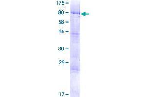 TRMT6 Protein (AA 1-497) (GST tag)