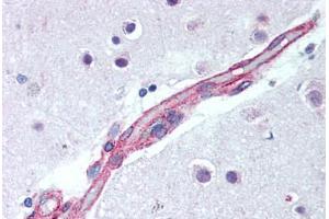 Brain, cortex, capillary (JNK2 抗体  (AA 373-389))