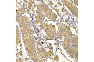 Immunohistochemistry of paraffin-embedded human stomach using RASGRF1 antibody (ABIN5974188) at dilution of 1/100 (40x lens). (RASGRF1 抗体)