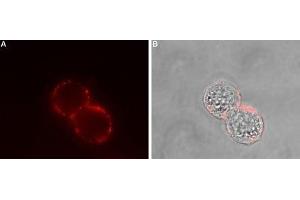 Immunocytochemistry (ICC) image for anti-Somatostatin Receptor 2 (SSTR2) (AA 30-43), (Extracellular) antibody (ABIN7043765)