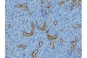 ABIN6279279 at 1/100 staining Mouse kidney tissue by IHC-P. (CEP72 抗体)