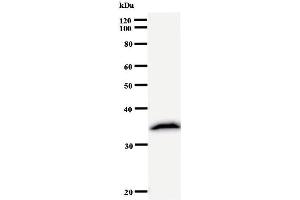 Western Blotting (WB) image for anti-Ribonuclease P/MRP 30kDa Subunit (RPP30) antibody (ABIN933123) (RPP30 抗体)
