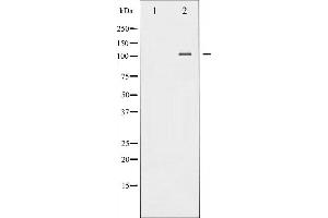 Western blot analysis of NF- kappaB p100/p52 phosphorylation expression in TNF-α treated MDA-MB-435 whole cell lysates,The lane on the left is treated with the antigen-specific peptide. (NFKB2 抗体  (pSer870))