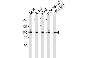 Western blot analysis of lysates from A431, Jurkat, K562, MDA-MB-231, U-251 MG cell line (from left to right), using ZN Antibody (N-term) (ABIN1944760 and ABIN2838552). (ZNF175 抗体  (N-Term))