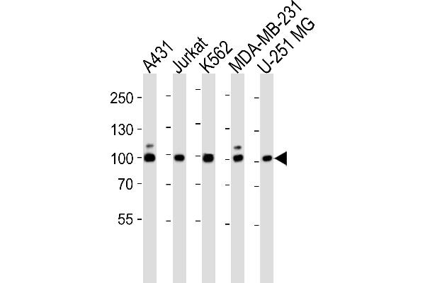 ZNF175 抗体  (N-Term)