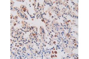 IHC-P analysis of lung tissue, with DAB staining. (IL17RA 抗体  (AA 377-534))