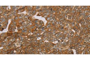 Immunohistochemistry (Paraffin-embedded Sections) (IHC (p)) image for anti-Pleckstrin Homology Domain Containing, Family G (With RhoGef Domain) Member 6 (PLEKHG6) antibody (ABIN7237452)
