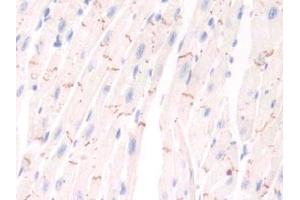 DAB staining on IHC-P; Samples: Mouse Cardiac Muscle Tissue (PIM1 抗体  (AA 122-261))