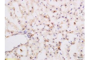 Formalin-fixed and paraffin embedded rat liver labeled with Rabbit Anti-Substance P Polyclonal Antibody at 1:200 followed by conjugation to the secondary antibody and DAB staining. (Substance P 抗体  (AA 58-68))