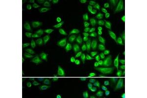 Immunofluorescence analysis of MCF-7 cells using PTPN1 Polyclonal Antibody (PTPN1 抗体)