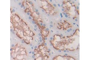 Used in DAB staining on fromalin fixed paraffin- embedded kidney tissue (DPEP2 抗体  (AA 303-486))
