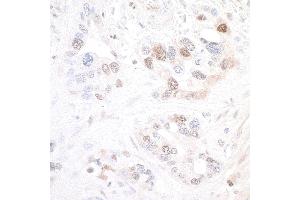 Immunohistochemistry (IHC) image for anti-Nicotinamide phosphoribosyltransferase (NAMPT) (AA 400-450) antibody (ABIN7454014) (Recombinant NAMPT 抗体  (AA 400-450))