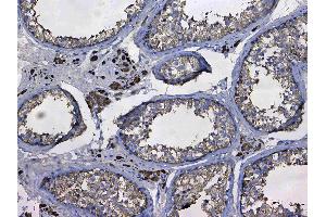 Immunohistochemistry (IHC) image for anti-Glutathione S-Transferase mu 3 (Brain) (GSTM3) (AA 93-206) antibody (ABIN5693252)