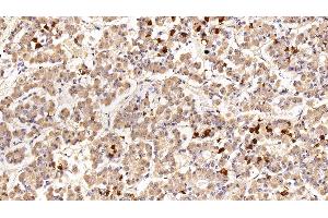 Detection of PRL in Porcine Pituitary Tissue using Polyclonal Antibody to Prolactin (PRL) (Prolactin 抗体  (AA 31-229))