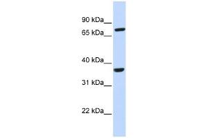 CCRL2 antibody used at 1 ug/ml to detect target protein. (CCRL2 抗体)