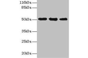 Western blot All lanes: KRT38 antibody at 2 μg/mL Lane 1: MCF-7 whole cell lysate Lane 2: Hela whole cell lysate Lane 3: HepG2 whole cell lysate Secondary Goat polyclonal to rabbit IgG at 1/10000 dilution Predicted band size: 51 kDa Observed band size: 51 kDa (KRT38 抗体  (AA 2-456))