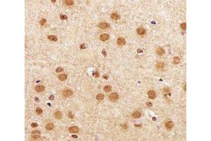 Immunohistochemistry (IHC) image for anti-Sirtuin 1 (SIRT1) (AA 566-601) antibody (ABIN3032583)