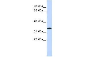 WB Suggested Anti-TRIM14 Antibody Titration:  0. (TRIM14 抗体  (Middle Region))