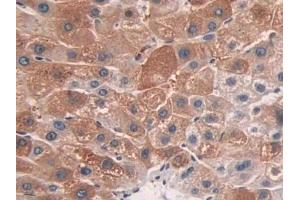 Immunohistochemistry (IHC) image for anti-Cytochrome P450, Family 26, Subfamily A, Polypeptide 1 (CYP26A1) (AA 73-255) antibody (ABIN7435541)