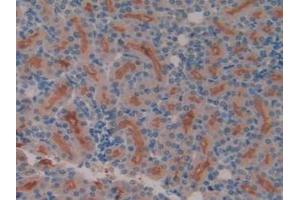 IHC-P analysis of Rat Kidney Tissue, with DAB staining. (Meprin B 抗体  (AA 433-679))