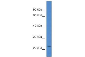WB Suggested Anti-Csrp2 Antibody   Titration: 1. (CSRP2 抗体  (Middle Region))