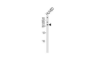 Western blot analysis of lysate from HUVEC cell line,using SIX6 Antibody (ABIN6242057). (SIX Homeobox 6 抗体)