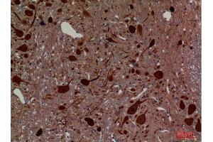 Immunohistochemistry (IHC) analysis of paraffin-embedded Rat Brain, antibody was diluted at 1:100. (Hexosaminidase A 抗体  (Internal Region))