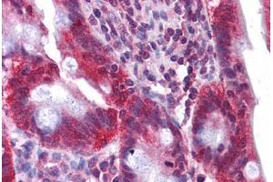 Human Small Intestine: Formalin-Fixed, Paraffin-Embedded (FFPE) (HNF4A 抗体  (C-Term))