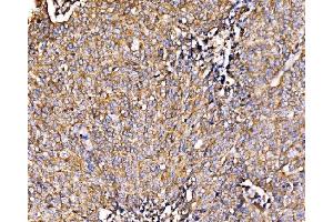 IHC analysis of HIP1R using anti-HIP1R antibody (ABIN7601290). (HIP1R 抗体  (AA 316-734))