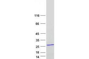 Western Blotting (WB) image for Fast Skeletal Troponin I (TNNI2) (Transcript Variant 2) protein (Myc-DYKDDDDK Tag) (ABIN2720885)