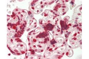 Human Placenta: Formalin-Fixed, Paraffin-Embedded (FFPE). (MAMSTR 抗体  (AA 9-37))