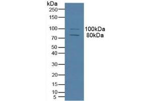 Detection of MAP4 in Human Hela Cells using Polyclonal Antibody to Microtubule Associated Protein 4 (MAP4) (MAP4 抗体  (AA 2-250))