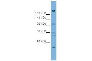 DIP2A antibody used at 1 ug/ml to detect target protein. (DIP2A 抗体)