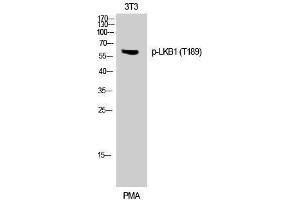 Western Blotting (WB) image for anti-serine/threonine Kinase 11 (STK11) (pThr189) antibody (ABIN3182225) (LKB1 抗体  (pThr189))