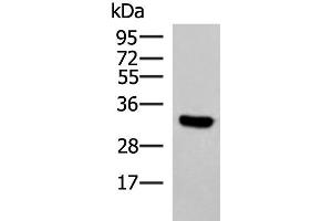 Western blot analysis of Hela cell lysate using KCTD7 Polyclonal Antibody at dilution of 1:1200 (KCTD7 抗体)