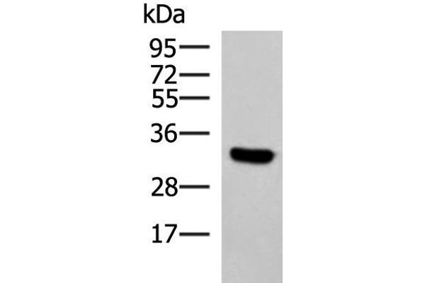 KCTD7 抗体