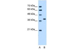 Western Blot showing RUNDC2A antibody used at a concentration of 5. (SNX29 抗体  (N-Term))