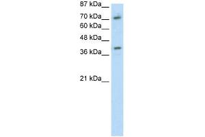 WB Suggested Anti-ZNF282 Antibody Titration: 1. (ZNF282 抗体  (C-Term))